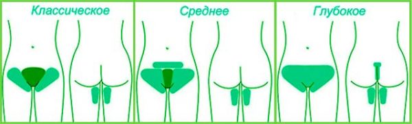 Схема классического, среднего и глубокого бикини
