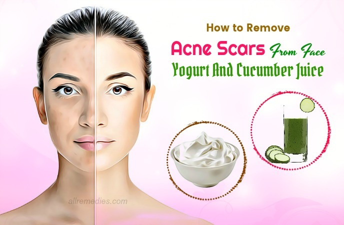 how to remove acne scars from face