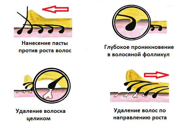 Как действует шугаринт