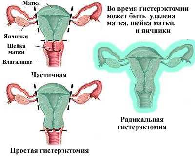 Фото как расположена матка